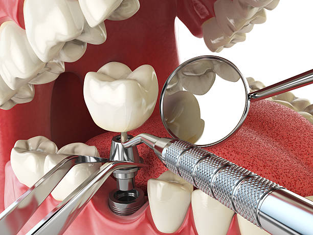 Best Emergency TMJ Treatment in Carter, TX